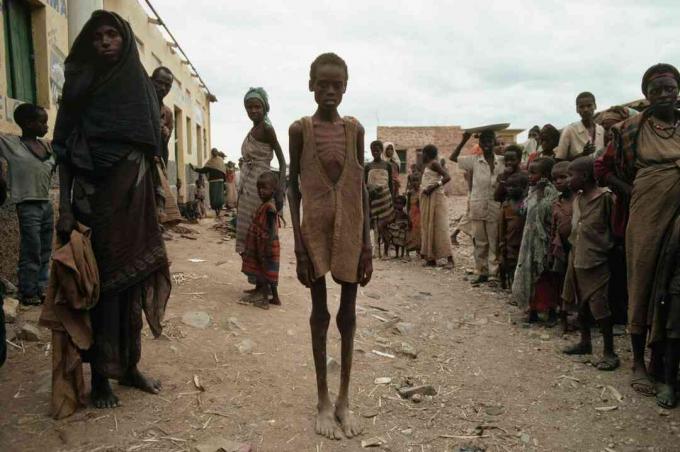 ضحايا المجاعة الناتجة عن الحرب الأهلية الصومالية.