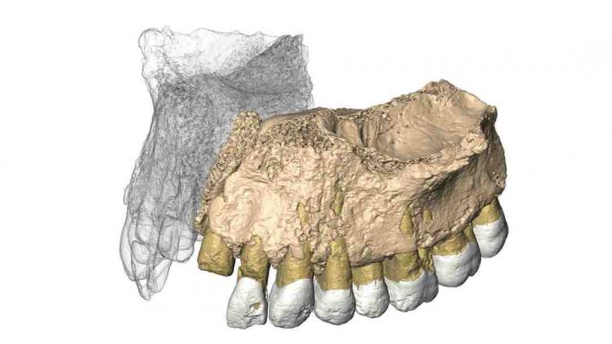 Mislaya Maxilla المعاد بناؤها