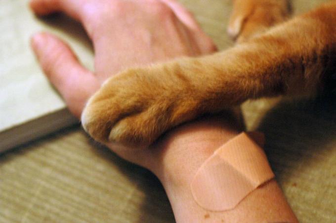 يد بشرية ضمادة ومخلب القط.